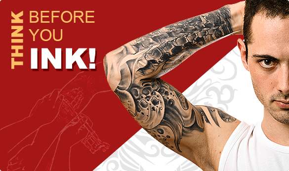 Tattoo removal in Toronto