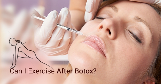 Botox treatment Toronto